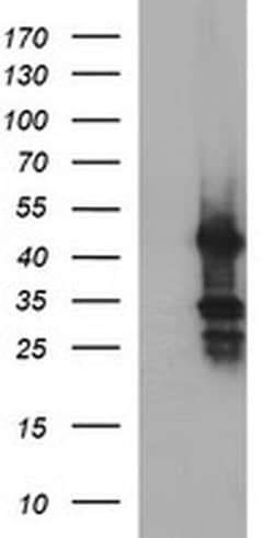 MFAP3 Monoclonal Antibody (OTI2D2), TrueMAB , OriGene:Antibodies:Primary