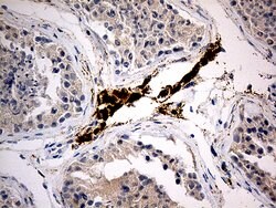 MGARP Mouse anti-Human, Clone: OTI5B6, liquid, TrueMAB 100 &mu;L; Unconjugated:Antibodies,