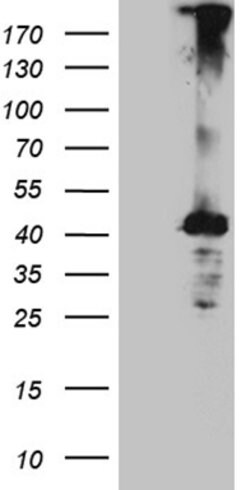 MGARP Monoclonal Antibody (OTI3D9), TrueMAB , OriGene:Antibodies:Primary