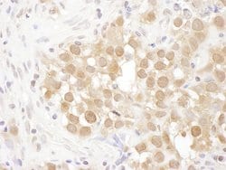 MGEA5 Rabbit anti-Human, Polyclonal, Bethyl Laboratories 10 &mu;L; Unconjugated:Antibodies,