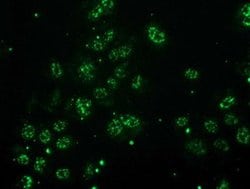 MGLL Monoclonal Antibody (OTI2B11), TrueMAB , OriGene 100 &mu;L; Unconjugated:Antibodies,