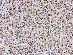 MGLL Monoclonal Antibody (OTI2B11), TrueMAB , OriGene:Antibodies:Primary