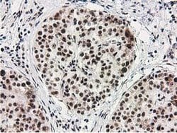 MGLL Monoclonal Antibody (OTI2B11), TrueMAB , OriGene 100 &mu;L; Unconjugated:Antibodies,