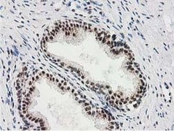 MGLL Monoclonal Antibody (OTI2B11), TrueMAB , OriGene 100 &mu;L; Unconjugated:Antibodies,