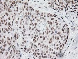 MGLL Monoclonal Antibody (OTI2B11), TrueMAB , OriGene 100 &mu;L; Unconjugated:Antibodies,