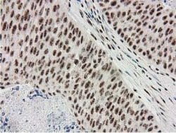 MGLL Monoclonal Antibody (OTI2B11), TrueMAB , OriGene 100 &mu;L; Unconjugated:Antibodies,