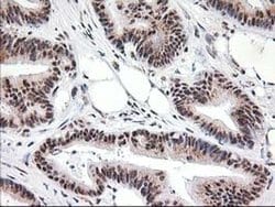 MGLL Monoclonal Antibody (OTI2B11), TrueMAB , OriGene 100 &mu;L; Unconjugated:Antibodies,
