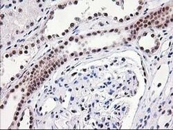 MGLL Monoclonal Antibody (OTI2B11), TrueMAB , OriGene 100 &mu;L; Unconjugated:Antibodies,