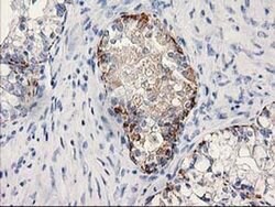 MGLL Monoclonal Antibody (OTI1A1), TrueMAB , OriGene:Antibodies:Primary