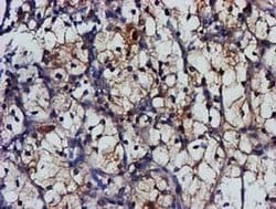 MGLL Monoclonal Antibody (OTI1H2), TrueMAB , OriGene 30 &mu;L; Unconjugated:Antibodies,