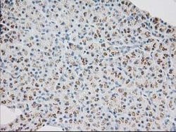 MGLL Mouse anti-Human, Clone: OTI1C6, lyophilized, TrueMAB 100 &mu;g; Unconjugated:Antibodies,