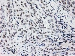 MGLL Mouse anti-Human, Clone: OTI1C6, lyophilized, TrueMAB 100 &mu;g; Unconjugated:Antibodies,