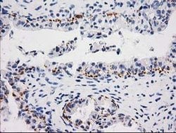 MGLL Monoclonal Antibody (OTI 2B6), TrueMAB , OriGene 100 &mu;L; Unconjugated:Antibodies,