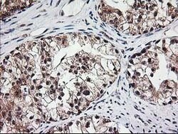 MGLL Mouse anti-Human, Clone: OTI4D1, lyophilized, TrueMAB 100 &mu;g; Unconjugated:Antibodies,