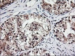 MGLL Monoclonal Antibody (OTI4D1), TrueMAB , OriGene 100 &mu;L; Unconjugated:Antibodies,