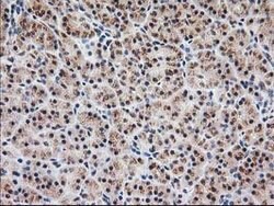 MGLL Mouse anti-Human, Clone: OTI4D1, lyophilized, TrueMAB 100 &mu;g; Unconjugated:Antibodies,