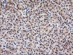 MGLL Monoclonal Antibody (OTI4D1), TrueMAB , OriGene 100 &mu;L; Unconjugated:Antibodies,