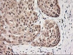 MGLL Mouse anti-Human, Clone: OTI4D1, lyophilized, TrueMAB 100 &mu;g; Unconjugated:Antibodies,