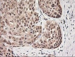 MGLL Monoclonal Antibody (OTI4D1), TrueMAB , OriGene 100 &mu;L; Unconjugated:Antibodies,