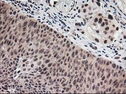 MGLL Mouse anti-Human, Clone: OTI4D1, lyophilized, TrueMAB 100 &mu;g; Unconjugated:Antibodies,