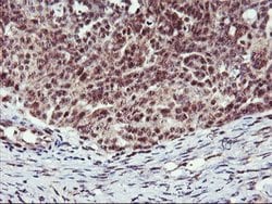 MGLL Mouse anti-Human, Clone: OTI1B1, lyophilized, TrueMAB 100 &mu;g; Unconjugated:Antibodies,