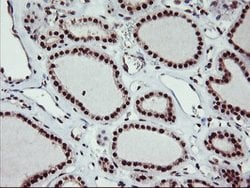 MGLL Mouse anti-Human, Clone: OTI1B1, lyophilized, TrueMAB 100 &mu;g; Unconjugated:Antibodies,