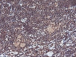 MGLL Mouse anti-Human, Clone: OTI1B1, lyophilized, TrueMAB 100 &mu;g; Unconjugated:Antibodies,