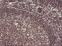MGLL Mouse anti-Human, Clone: OTI1B1, lyophilized, TrueMAB 100 &mu;g; Unconjugated:Antibodies,