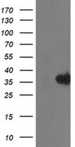 MGLL Monoclonal Antibody (OTI2B11), TrueMAB , OriGene 100 &mu;L; Unconjugated:Antibodies,