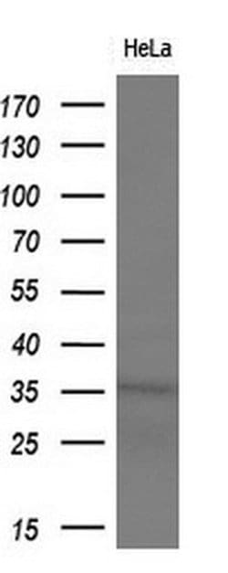 MGLL Monoclonal Antibody (OTI2B11), TrueMAB , OriGene 100 &mu;L; Unconjugated:Antibodies,