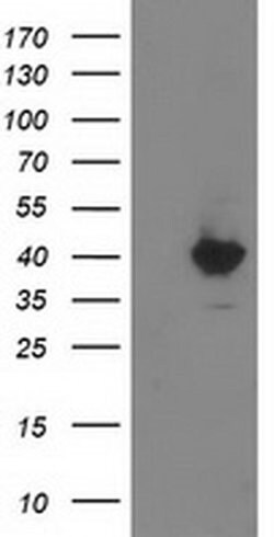 MGLL Monoclonal Antibody (OTI1A1), TrueMAB , OriGene 100 &mu;L; Unconjugated:Antibodies,