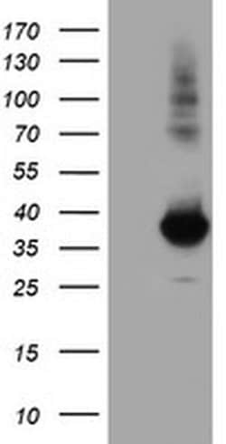 MGLL Monoclonal Antibody (OTI1H2), TrueMAB , OriGene 30 &mu;L; Unconjugated:Antibodies,