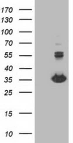 MGLL Mouse anti-Human, Clone: OTI1C6, lyophilized, TrueMAB 100 &mu;g; Unconjugated:Antibodies,