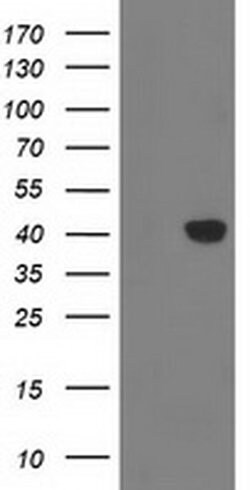 MGLL Mouse anti-Human, Clone: OTI2G8, liquid, TrueMAB 100 &mu;L; Unconjugated:Antibodies,