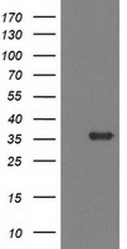 MGLL Monoclonal Antibody (OTI 2B6), TrueMAB , OriGene:Antibodies:Primary