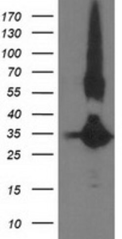 MGLL Mouse anti-Human, Clone: OTI4D1, lyophilized, TrueMAB 100 &mu;g; Unconjugated:Antibodies,