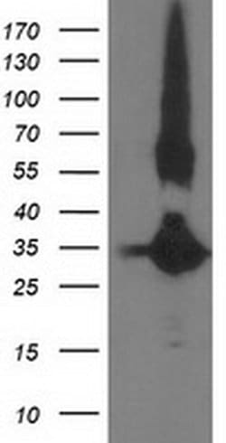 MGLL Monoclonal Antibody (OTI4D1), TrueMAB , OriGene 100 &mu;L; Unconjugated:Antibodies,