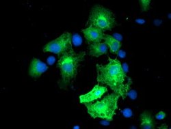 MGLL Mouse anti-Human, Clone: OTI1B1, lyophilized, TrueMAB 100 &mu;g; Unconjugated:Antibodies,