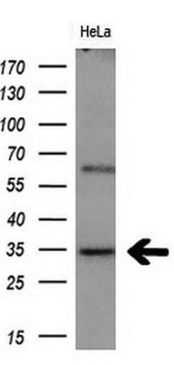 MGLL Mouse anti-Human, Clone: OTI1B1, lyophilized, TrueMAB 100 &mu;g; Unconjugated:Antibodies,
