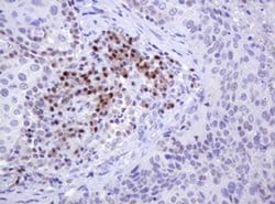 MGMT Monoclonal Antibody (OTI4E6), TrueMAB , OriGene 100 &mu;L; Unconjugated:Antibodies,