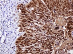 MGMT Monoclonal Antibody (OTI4E6), TrueMAB , OriGene:Antibodies:Primary