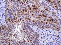 MGMT Monoclonal Antibody (OTI4E6), TrueMAB , OriGene 100 &mu;L; Unconjugated:Antibodies,