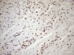 MGMT Monoclonal Antibody (OTI6C4), TrueMAB , OriGene 100 μL; Unconjugated:Antibodies,