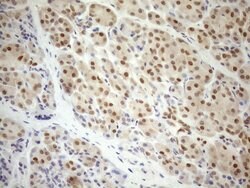 MGMT Monoclonal Antibody (OTI6C4), TrueMAB , OriGene 100 μL; Unconjugated:Antibodies,