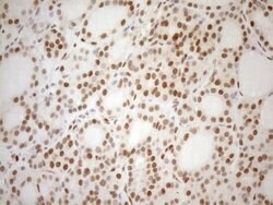 MGMT Monoclonal Antibody (OTI6C4), TrueMAB , OriGene 100 μL; Unconjugated:Antibodies,