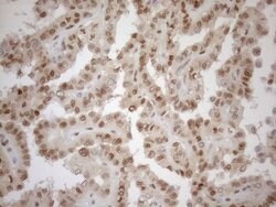 MGMT Monoclonal Antibody (OTI6C4), TrueMAB , OriGene 100 μL; Unconjugated:Antibodies,