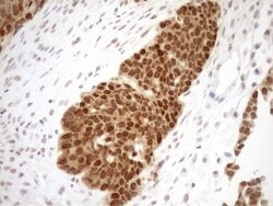 MGMT Monoclonal Antibody (OTI6C4), TrueMAB , OriGene 100 μL; Unconjugated:Antibodies,