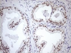MGMT Monoclonal Antibody (OTI6C4), TrueMAB , OriGene 100 μL; Unconjugated:Antibodies,