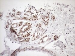 MGMT Monoclonal Antibody (OTI6C4), TrueMAB , OriGene 100 μL; Unconjugated:Antibodies,
