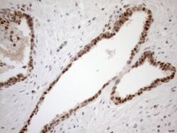 MGMT Monoclonal Antibody (OTI6C4), TrueMAB , OriGene 100 μL; Unconjugated:Antibodies,